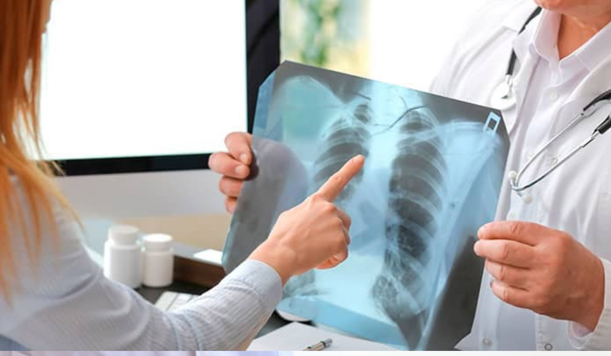 Pulmonologist
