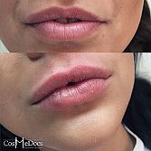 Cosmetic Surgery in London UK