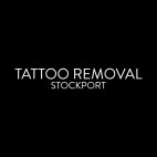TATTOO REMOVAL STOCKPORT